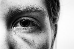 injured pain suffering